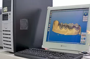 Cerec 3D лечение зубов и ЗD моделирование коронок и вкладок любой сложности в Немецком имплантологическом центре