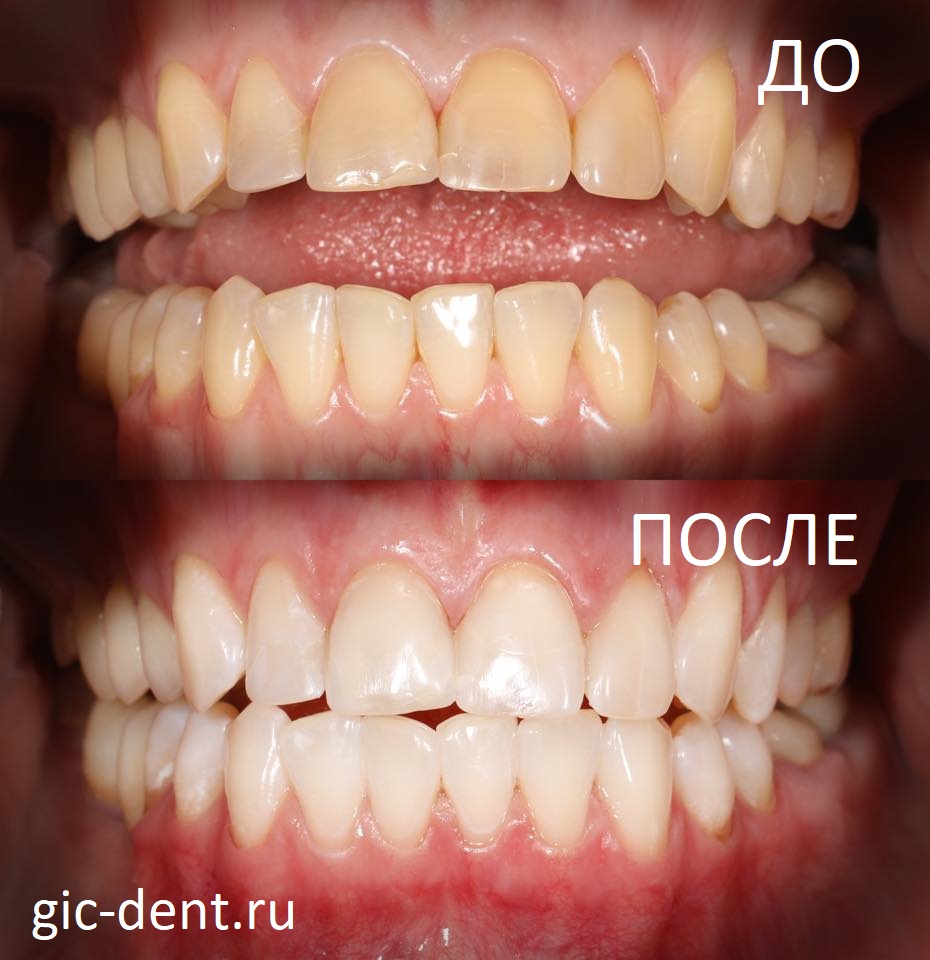 Цель и задачи терапевтической стоматологии для лечение зуба thumbnail
