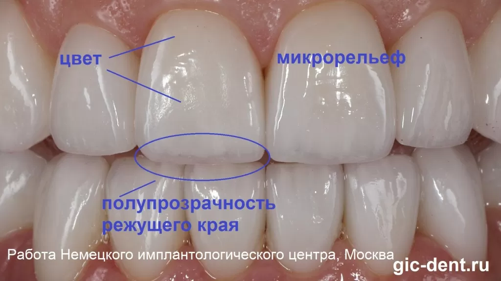 Самый совершенный и красивый зуб должен отвечать 3 основным правилам: цвет, режущая кромка и микрорельеф. Немецкий имплантологический центр