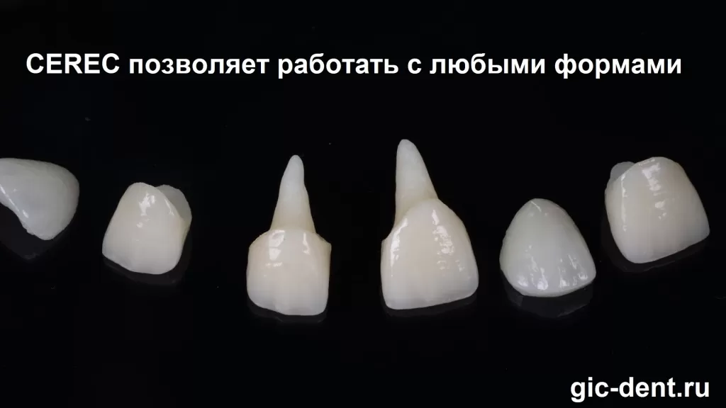 Различные формы зубов, сделанные по технологии CEREC