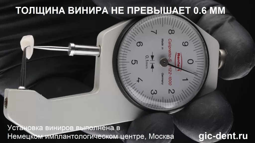 микрометр измеряет толщину винира, она не превышает 0,6 мм