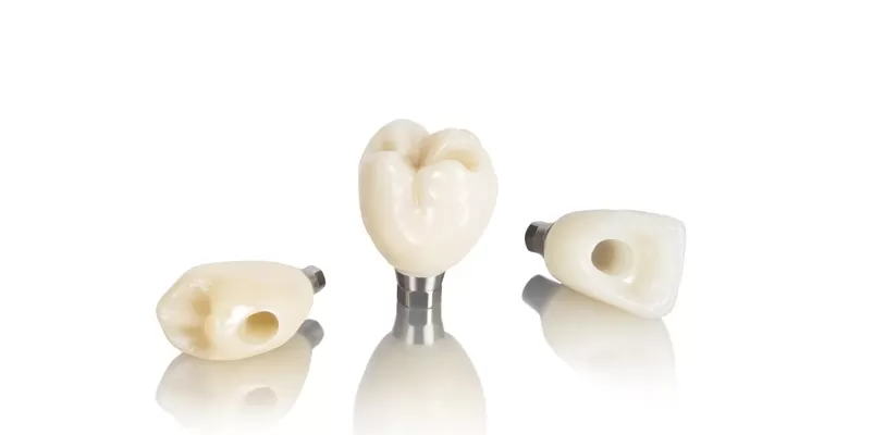 Установка коронок из диоксида циркония CAD/CAM на имплантах в стоматологической клинике DrShorbatov